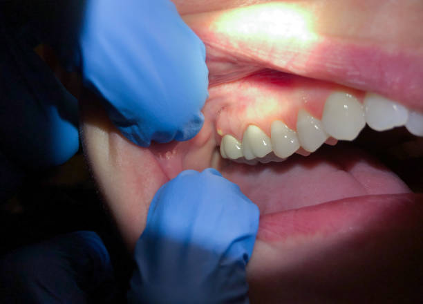 Best Dentist for Severe Toothache  in Charlotte, TN