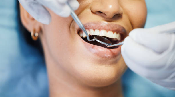 Best Emergency Dental Filling Replacement  in Charlotte, TN