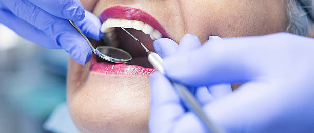 Best Root Canal Emergency Dentist  in Charlotte, TN